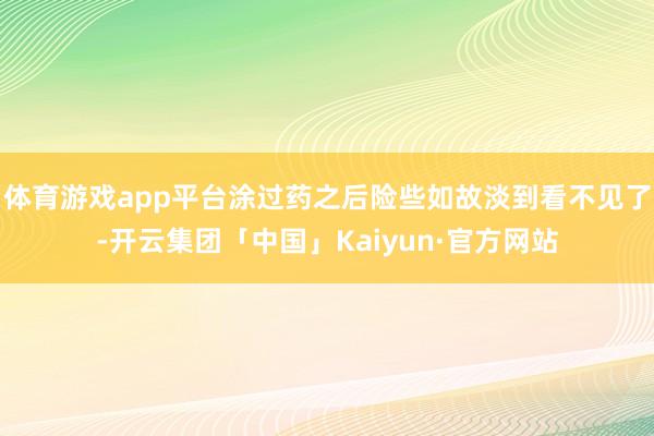 体育游戏app平台涂过药之后险些如故淡到看不见了-开云集团「中国」Kaiyun·官方网站